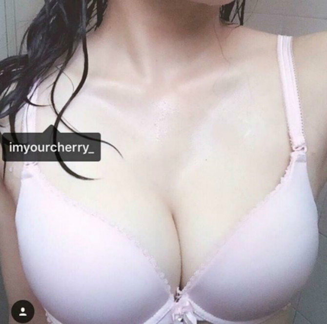 
후방
