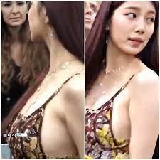 수지 옆슴