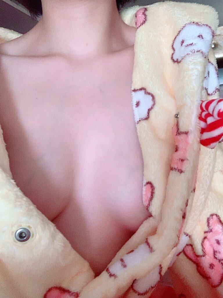 
실 핏 줄 ~
