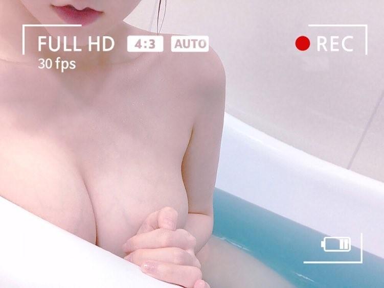 
실 핏 줄 ~
