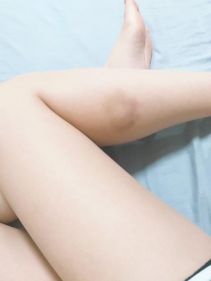 
오늘의 다리 2
